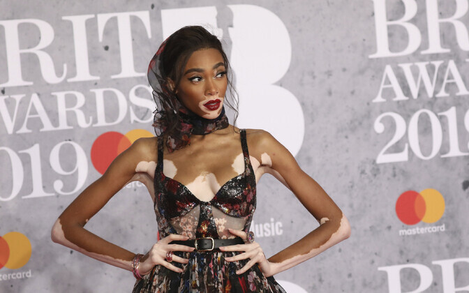 Winnie Harlow