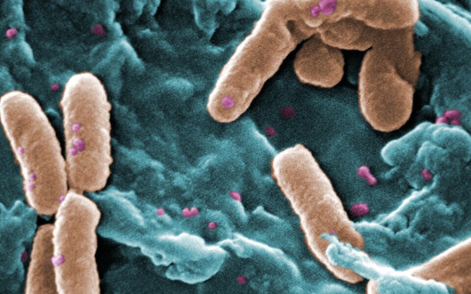 Bakter Pseudomonas aeruginosa.