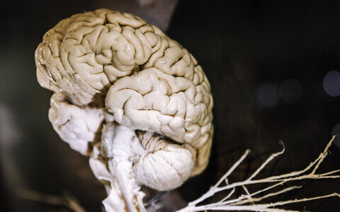 Mida rohkem ja regulaarsemalt aju treenida, seda tugevam on kaitsev mõju.